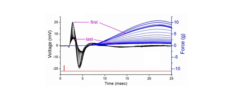 Graph of attack of periodic paralysis, induced by glucose infusion.