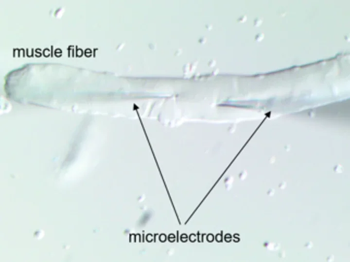 Three part-panel of Cannon lab members plus ion channelopathies of skeletal muscle.